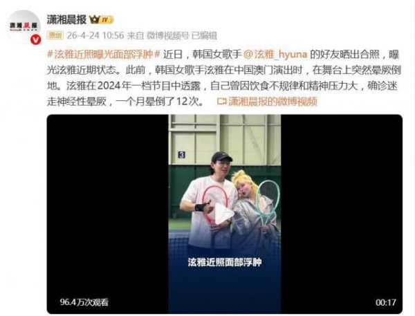 泫雅近照曝光“面部浮肿”引热议，曾自曝一个月晕倒了12次